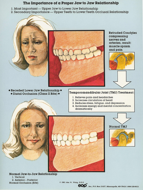 Nerve Pain In Jaw After Tooth Extraction